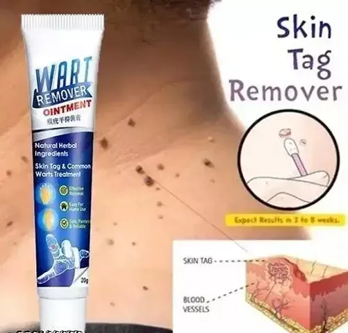 Must Have Wart Removing Ointment