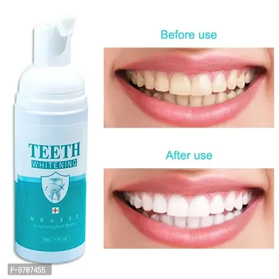 TEETH WHITENING FOAM 100% NATURAL RESULT-thumb0