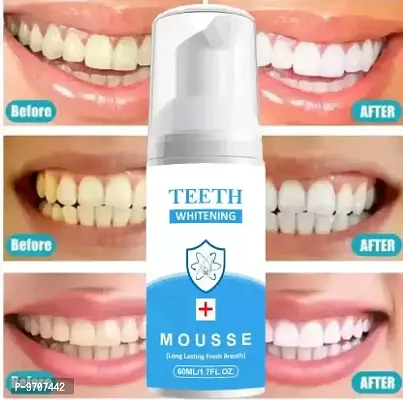 TEETH WHITENING FOAM 100% RESULT