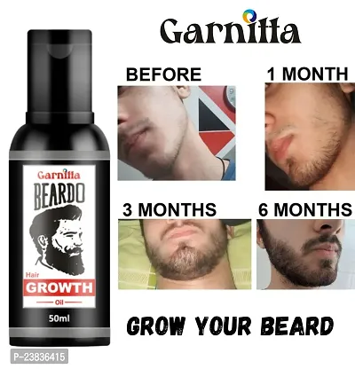 Organics Beard and Hair Growth Oil Non-Sticky Hair Oil(30 ml) Pack of 80