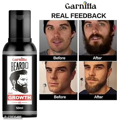 Organics Beard and Hair Growth Oil Non-Sticky Hair Oil(30 ml) Pack of 75