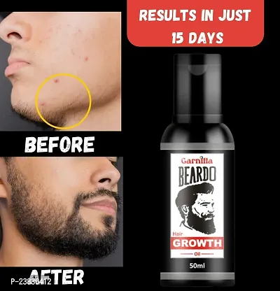 Organics Beard and Hair Growth Oil Non-Sticky Hair Oil(30 ml) Pack of 78-thumb0