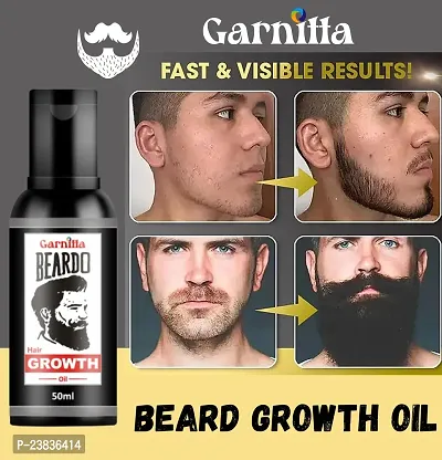 Organics Beard and Hair Growth Oil Non-Sticky Hair Oil(30 ml) Pack of 79