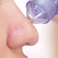 Derma Suction Blackhead Remover Vacuum Pimple Sucker Tool PACK OF 1-thumb2