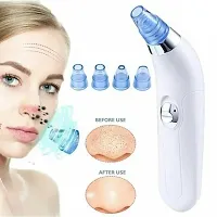 Electric Facial Skin Care Pore Blackhead Remover ( PACK OF 1 )-thumb1