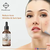 PuriFlame Acne Solution Skin Serum Reduces Acne, Marks & Wrinkles, Dark Spot Corretor All Skin Types 60 ML-thumb1