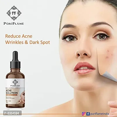 PuriFlame Acne Solution Skin Serum Reduces Acne, Marks & Wrinkles, Dark Spot Corretor All Skin Types 60 ML-thumb2