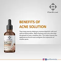 PuriFlame Acne Solution Skin Serum Reduces Acne, Marks & Wrinkles, Dark Spot Corretor All Skin Types 120 ML-thumb2