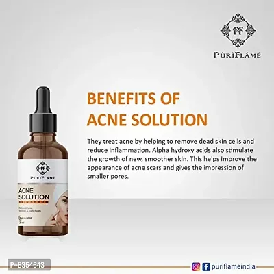 PuriFlame Acne Solution Skin Serum Reduces Acne, Marks & Wrinkles, Dark Spot Corretor All Skin Types 120 ML-thumb3