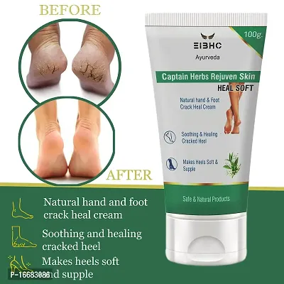 EIBHC Healthy Feet Foot Cream, Guaranteed Relief for Extremely Dry, Cracked Feet, Instantly Boosts Moisture Levels-200G-thumb4