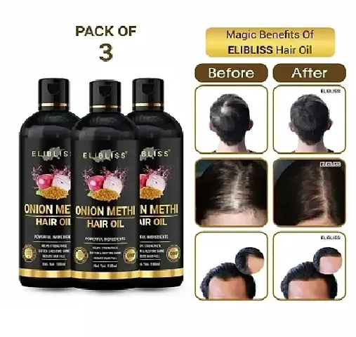 Herbal Onion Hair Oil For Hair Fall Control