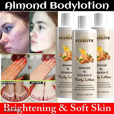 Regolith Almond  Vitamin -E Body Lotion Skin Whitening Body Lotion for Dry Skin Protection with Almond Oil  Vitamin E 100ML(Pack of 3)