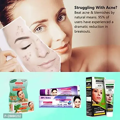 Panchvati Skin Care Kit Combo Pack, Acne Fighter Gel 50 g + Anti Marks Gel 60 g + Acne Goti Soap 25 g, 135g-thumb2