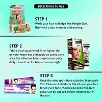 Panchvati Skin Care Kit Combo Pack, Acne Fighter Gel 50 g + Anti Marks Gel 60 g + Acne Goti Soap 25 g, 135g-thumb2