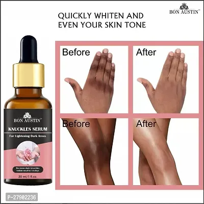 Bon Austin Knuckle Skin Whitening Serum, Pink Lip Serum, Eyebrow and Eyelash Growth Oil  Hair Growth Ginger Serum - Combo of 4 Items (Each, 30ML)-thumb2