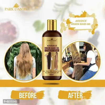 Park Daniel Advanced Onion Hair Oil For Reduces Hair Loss Fall Control 60 mL-thumb0