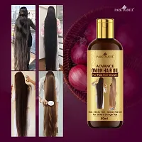 Park Daniel Advanced Onion Hair Oil For Reduces Hair Loss/Fall Control 180 Ml Pack Of 3-thumb1