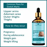 Park Daniel Stretch Marks Removal Oil Combo Pack of 4, 30 ML Each-thumb4