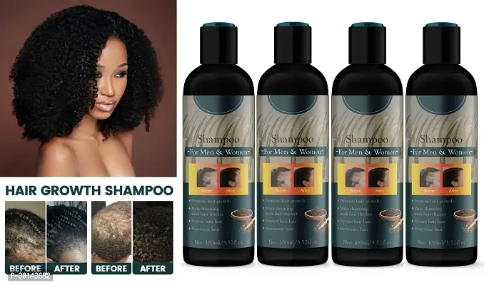 Anti Hair Loss Shampoo Pack of 4