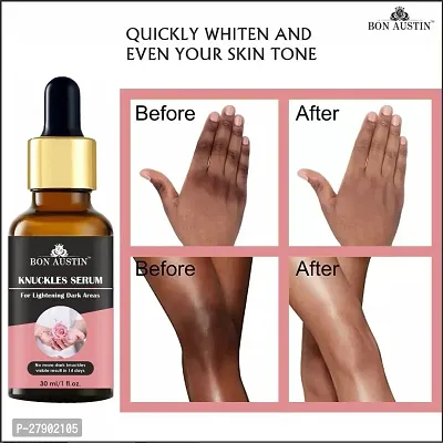 Bon Austin Knuckle Skin Whitening Serum, Pink Lip Serum  Eyebrow and Eyelash Growth Oil (Each, 30ml) Combo of 3 Items-thumb2