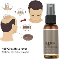 Unisex Natural Ginger Hair Spray, Hair Growth Serum, Hair Growth Treatment, Anti Hair Loss, Thinning, Balding, Repairs Hair Pack of 4 Bottle of 30ML-thumb4