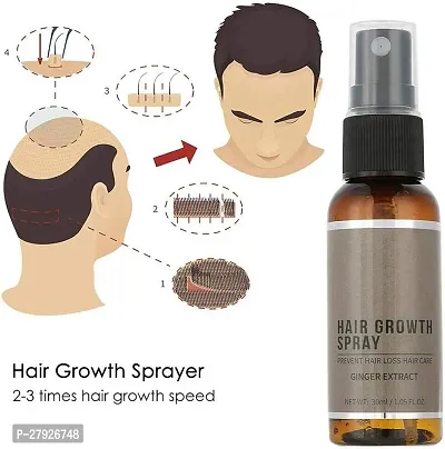Unisex Natural Ginger Hair Spray, Hair Growth Serum, Hair Growth Treatment, Anti Hair Loss, Thinning, Balding, Repairs Hair Pack of 4 Bottle of 30ML-thumb5