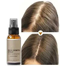 Ginger Hair Spray, Hair Growth Serum, Hair Growth Treatment, Anti Hair Loss, Thinning, Balding, Repairs Hair (30ML) Pack of 3-thumb2