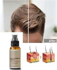 Ginger Hair Spray, Hair Growth Serum, Hair Growth Treatment, Anti Hair Loss, Thinning, Balding, Repairs Hair (30ML) Pack of 4-thumb3