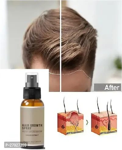 Ginger Hair Spray, Hair Growth Serum, Hair Growth Treatment, Anti Hair Loss, Thinning, Balding, Repairs Hair (30ML) Pack of 4-thumb4