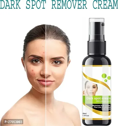 Dark Spot Corrector Cream | Brightening  Lightening | Pimple Marks | Acne Scars | Uneven Skin Tone - Pack of 1 Bottle of 50ml