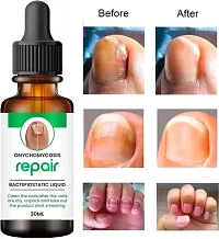 Natural Nails Repair Essential Oil 30 Ml-thumb1