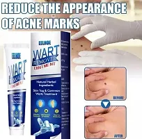 Wart Remover Ointment Treatment ,  Skin Face Tag Remover cream, Painless Wart Treatment cream (100gm) Pack of 1-thumb4