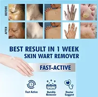 Wart Remover Ointment Treatment ,  Skin Face Tag Remover cream, Painless Wart Treatment cream (100gm) Pack of 1-thumb2