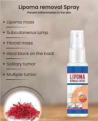 Natural Unisex Lipoma Remover Spray Relief Lipolysis Fat Lump With Lipoma Spray (30ml) Pack of 1-thumb1