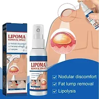 Natural Unisex Lipoma Remover Spray Relief Lipolysis Fat Lump With Lipoma Spray (30ml) Pack of 1-thumb3