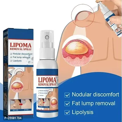 Lipoma Remover Spray Painless Herbal Lipolysis Fat Relief for Men and Women (30ml) Pack of 1-thumb4