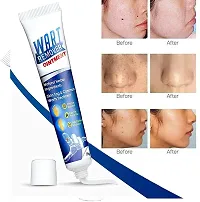 Wart Remover Ointment Cream Mask Gel | Pack of 1-thumb1