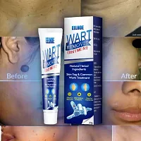 Wart Remover Ointment Cream Mask Gel | Pack of 1-thumb4