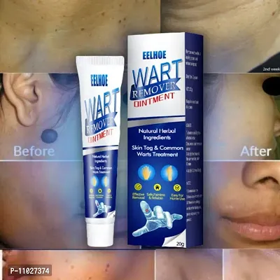 Wart Remover Ointment Cream Mask Gel | Pack of 1-thumb5