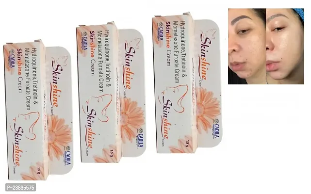skin shine cream 15g pack of 3
