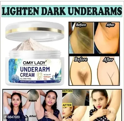 LS Omy Lady Cream for Skin whitening and Underarm Whitening Dirt Removal and Tan Removal Cream 1-thumb0