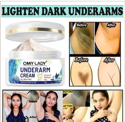 LS Omy Lady Cream for Skin whitening and Underarm Whitening Dirt Removal and Tan Removal Cream 1