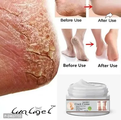 Litaligel Crack Blaster Repair - Cracked Skin, Heel, Finger Healing Balm and Crack Blaster Dry Skin and Body Cream (50gm)-thumb0