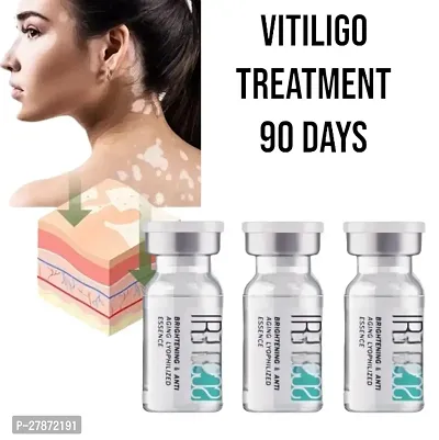 Effectively Remove Vitiligo Ointment Remove Ringworm White Spot Removal Skin Vitiligo Eliminate Vitiligo Skin Care/ 10ml (set of 3)-thumb0