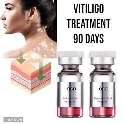 Vitiligo Ointment To Remove Ringworm/  Herbal CREAM/  vitiligo treatment 90 days / 10ml (set of 2)