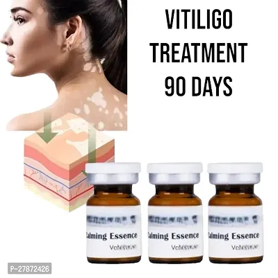 Vitiligo Repair Cream Remove Vitiligo Ointment White Spot Removal 90 DAYS/ 10ml (set of 3)