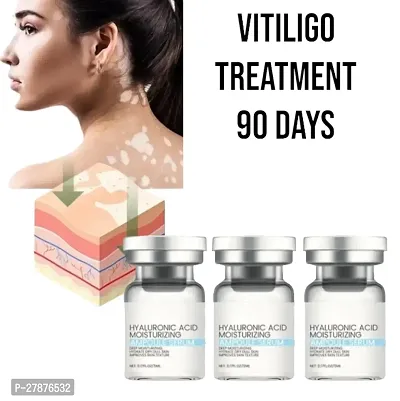 Effectively Remove Vitiligo Ointment Remove Ringworm White Spot Removal CREAM/ 90 days treatment 10ml (set of 3)