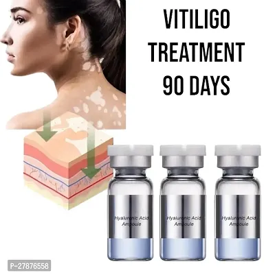 Anti vitiligo cream /vitiligo cream /vitiligo removal cream /vitiligo treatment/White Spot Removal/ 90 days treatment/ 10ml (set of 3)