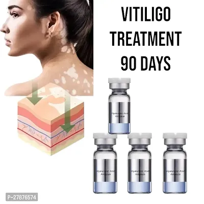 Removal Skin Vitiligo Eliminate/ Vitiligo Skin Care Cream/ vitiligo treatment 90 days 10ml (set of 4)