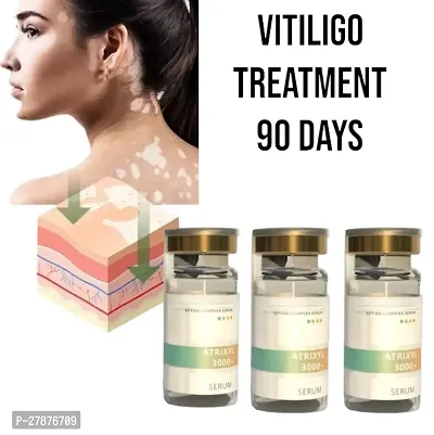 Effectively Remove/  Vitiligo White Spots/  Fades Skin Marks/  Skin Vitiligo Treatment 90 days 10ml (set of 3)-thumb0